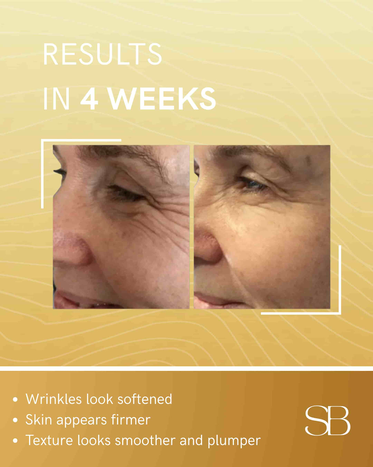 SungBoon™ Korean Multi-Peptide Collagen Serum