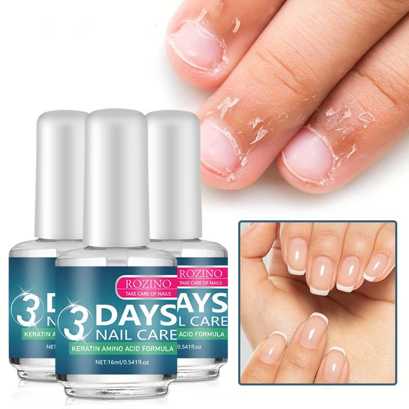 【Buy One, Get Two Free】Rozino 3 Days Nail Care Formula with Keratin Amino Acid & Aloe for Superior Nail Nourishment 16Ml Bottle for Healthy Nails Manicure